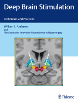 Deep brain stimulation 2019.pdf
